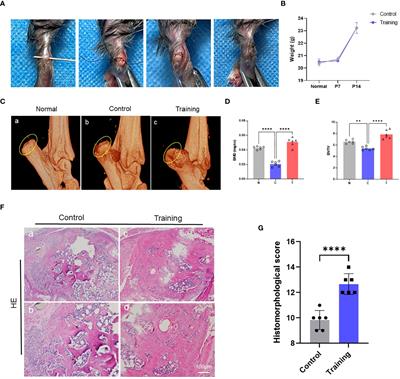 Inhibition of CX3CL1 by treadmill training prevents osteoclast-induced fibrocartilage complex resorption during TBI healing